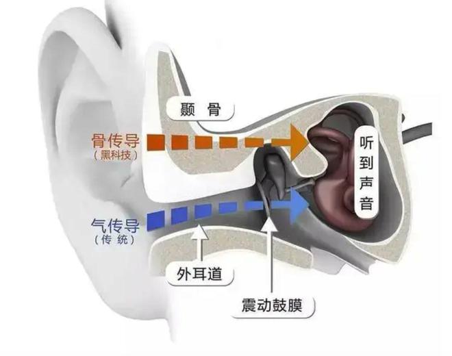 销量翻3倍开放式耳机会成为下一个Airpods吗？(图3)